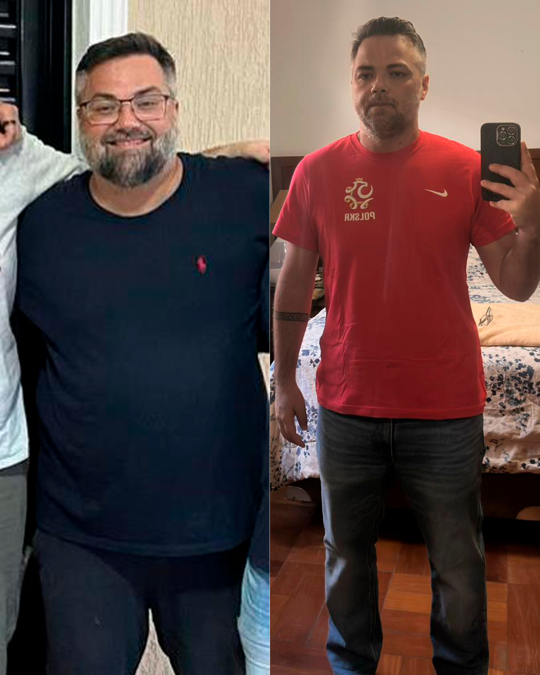 Anderson, 42 anos, emagreceu 50kg com o Método CORE